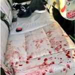 R.I.P 🛑🛑 Young woman dies at the hands of her… See more